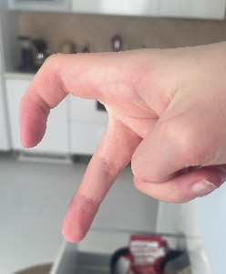 q